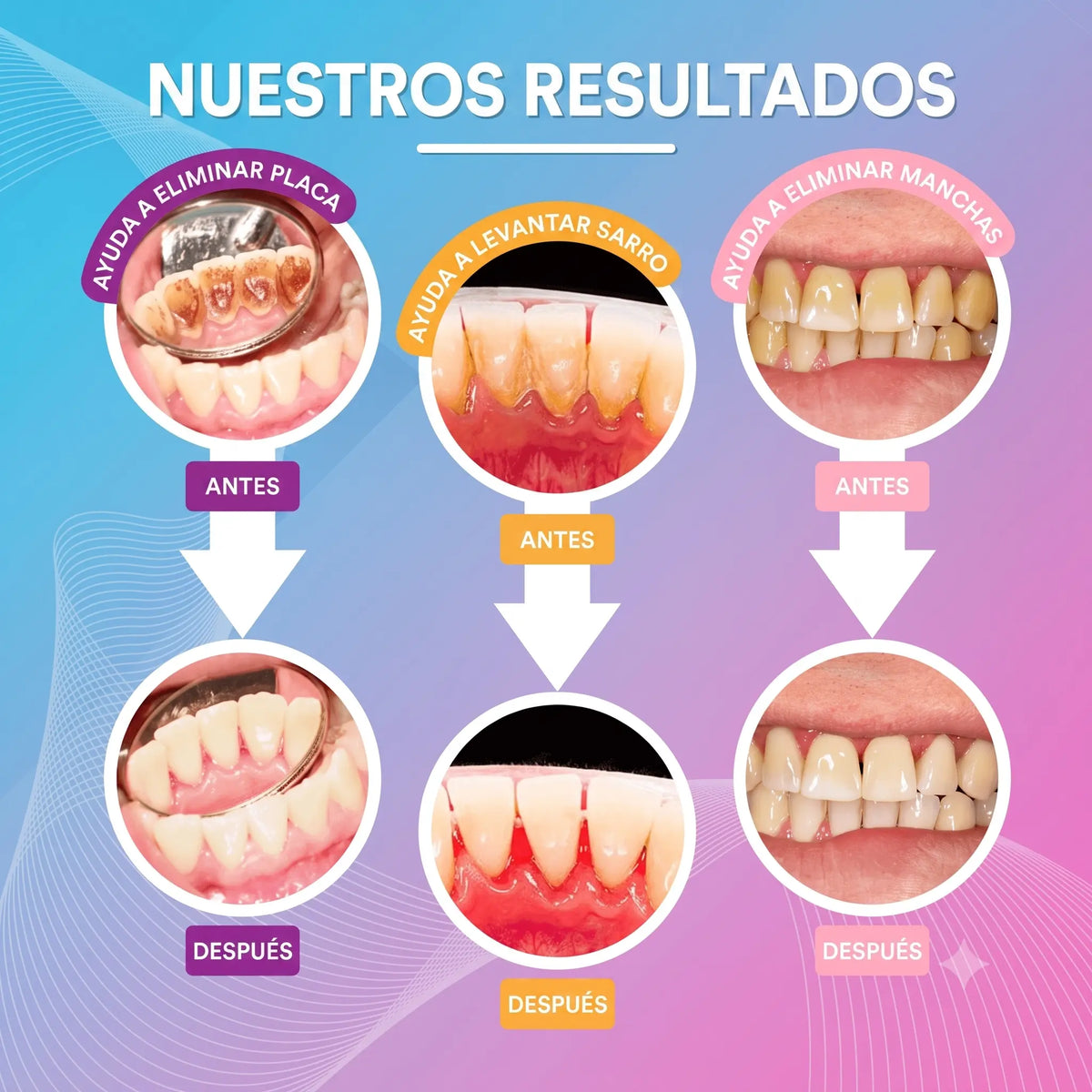 Recupera una sonrisa sin manchas — sin ir al dentista