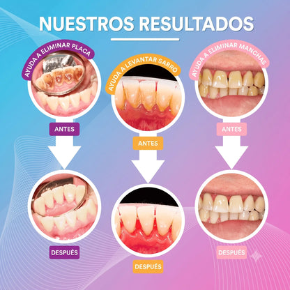 Recupera una sonrisa sin manchas — sin ir al dentista
